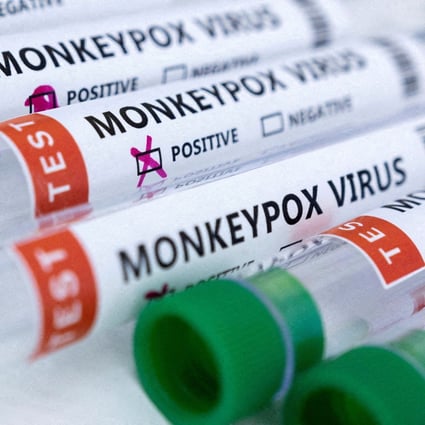 The monkeypox virus, which can cause painful sores and lesions all over the body, can be serious but is not often life-threatening. Photo illustration: Reuters