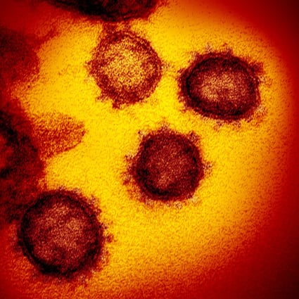 The reproductive rate of the coronavirus in Hong Kong has fallen below one for the first time in a month. Photo: AP