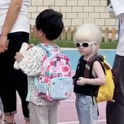 An apprehensive mother in China feared her albino daughter may be marginalised on her first day of kindergarten but was relieved after peers and teachers accepted the girl with open arms. Photo: SCMP composite