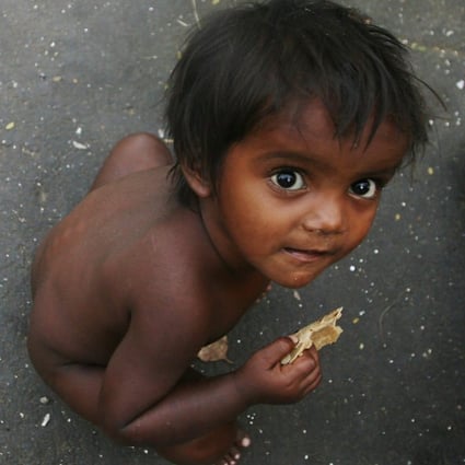 A boy in a Mumbai slum. More than 180 million Indians, including children, are undernourished. File photo: Reuters