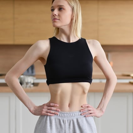 There are health consequences to sucking in your belly for too long, say experts. You will not get abs – instead, you will get “hourglass syndrome”. Photo: Shutterstock