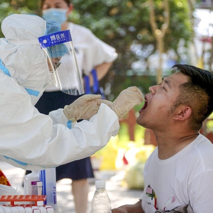 A man receives a nucleic acid test for Covid-19 in Zhengzhou, in China’s central Henan province, on July 31, 2021. Photo: AFP