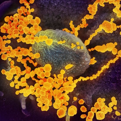 A study in Hong Kong looked at if, and how, Omicron subvariants behave differently in terms of impact on brain cells compared to earlier coronavirus strains. Image: AFP