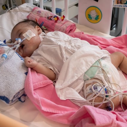 The smallest heart ever transplanted in the city was given to four-month-old Cleo Lai Tsz-hei last Friday after an unprecedented effort to secure the organ from a donor on the mainland. Photo: Hong Kong Children’s Hospital 