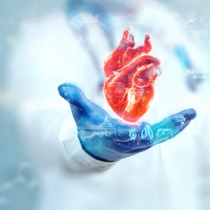 Heart attacks are a leading cause of death worldwide. Photo: Shutterstock  