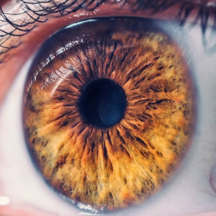 The retina is a layer of sensory cells required for clear vision. It can detach from the back of the eye for a variety of reasons. A detached retina requires prompt surgery to avoid losing sight in the eye. Photo: Shutterstock
