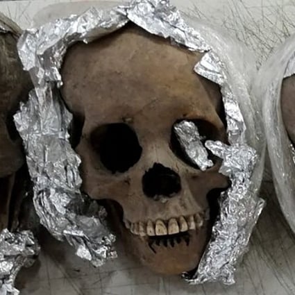 Four human skulls wrapped in plastic and aluminum foil were found by the National Guard inside a package bound for the United States at a courier company located at Mexico’s Queretaro Intercontinental airport. Photo: Mexican National Guard via Reuters