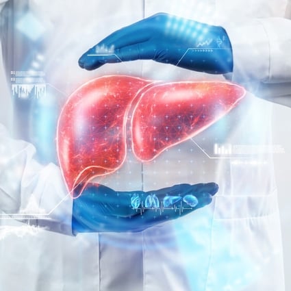 The University of Hong Kong has done a study on a new treatment plan for liver cancer patients. Photo: Shutterstock