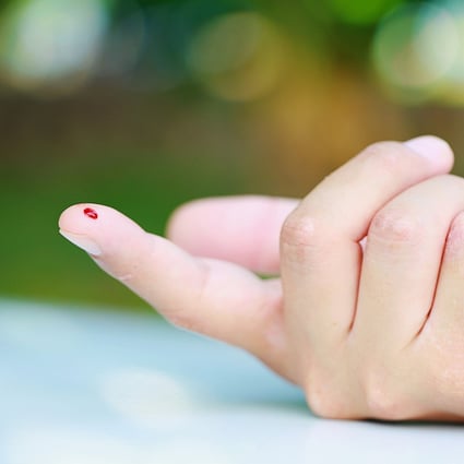 A new finger-prick blood test developed by a US geneticist could reveal much about your health – and save you from having to go to a doctor’s office to draw blood. Photo: Shutterstock