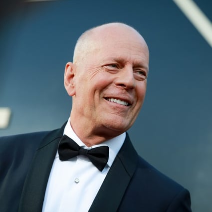 How Bruce Willis’ dementia type – FTD, or frontotemporal – differs from ...