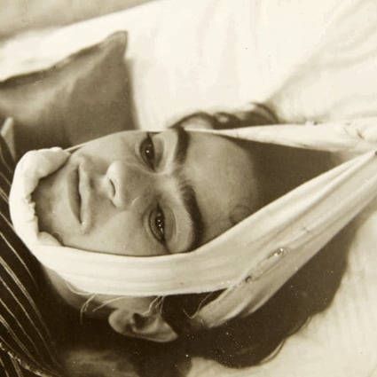 This 1940 photo shows artist Frida Kahlo with her head in bandages. The image is part of a collection of photographs by Nicholas Muray. Photo: Nickolas Muray via Sothebys