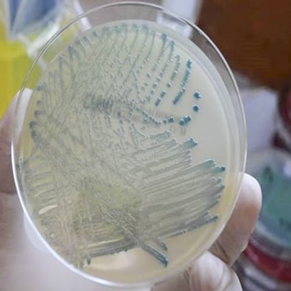 There were 972 cases of carbapenemase-producing enterobacteriaceae (CPE) detected in Hong Kong last year. Photo: Handout