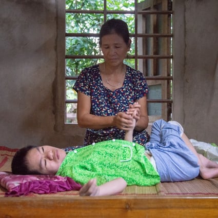 Nguyen Thi Tai has brain damage and muscular dystrophy, and relies on her mother Tran Thi Gai for care. Photo: Khairul Anwar