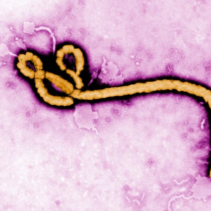 An Ebola virus as seen under a microscope. Photo: Handout