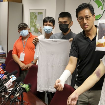 Four victims of the Yuen Long attack (left to right): a man surnamed Kwok and his 14-year-old son; injured passenger Leung with a bloody T-shirt; lawmaker Lam Cheuk-ting; and injured passenger Ma. Photo: Nora Tam
