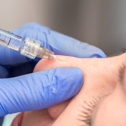The rapid growth of China’s medical beauty industry is accompanied by high-profile problems, including disfigurement of patients and botulinum toxin poisoning. Photo: Shutterstock