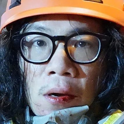 The Stand News reporter suffered wounds to his lips as he was punched in the face and hit to the ground while covering police’s mob dispersal operation in Yau Ma Tei on Friday. Photo: Handout