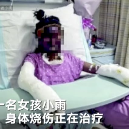 A 14-year-old girl died and her 12-year-old friend was badly burnt after they mimicked a cooking trick performed by an internet celebrity. Photo: Weibo