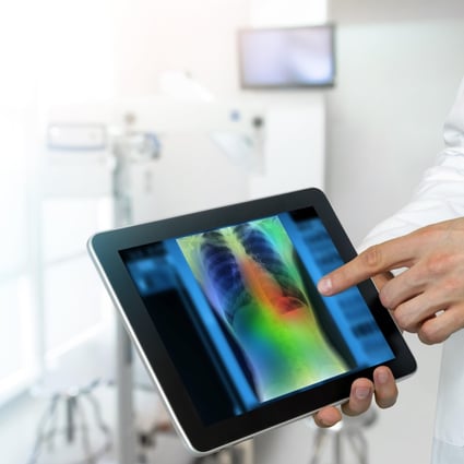 Artificial intelligence is pushing smart health care technology. Photo: Handout