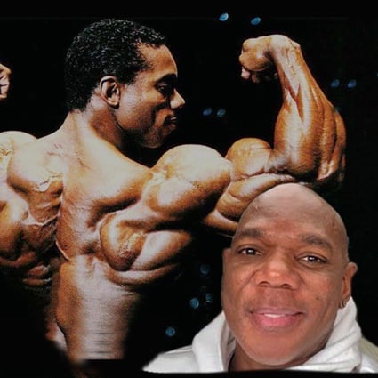 Bodybuilding Legend Flex Wheeler In Latest Personal Battle After Losing Part Of His Right Leg During Emergency Surgery South China Morning Post Bodybuilding Legend Flex Wheeler In Latest Personal Battle After Losing Part Of His Right Leg During Emergency Surgery South China Morning Post