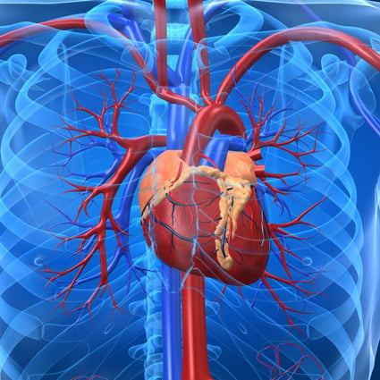 Heart diseases cost the US some US$555 billion in 2016, which is forecast to double to US$1.1 trillion by 2035, including health care services, medication and lost productivity, according to American Heart Association. Photo: Alamy