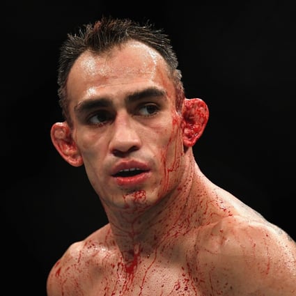 Tony Ferguson stares down opponent Anthony Pettis in their lightweight bout at UFC 229 in October 2018. Photo: AFP