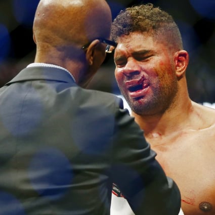 Alistair Overeem is tended to after an injury to his lip following his loss to Jairzinho Rozenstruik. Photos: USA TODAY Sports