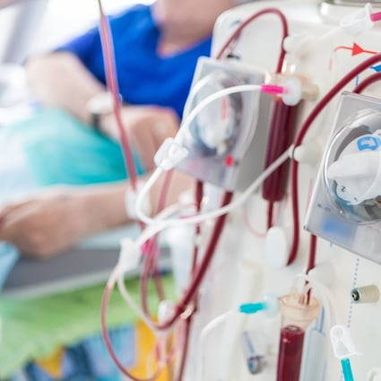 Dialysis is the only option for those whose kidneys are no longer able to perform their function naturally, aside from a kidney transplant. Photo: Shutterstock