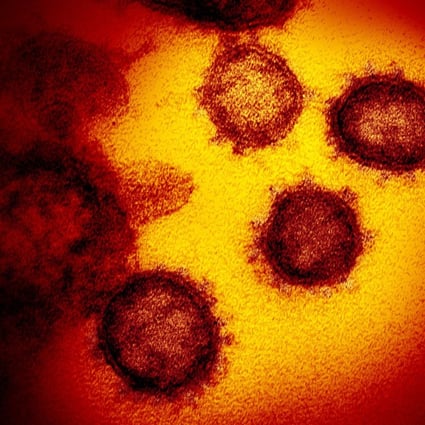 An electron microscope image shows the coronavirus emerging from the surface of cells. Photo: Handout