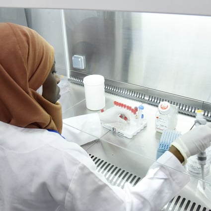 A scientist researches the coronavirus at the Pasteur Institute in Dakar, Senegal, which until two weeks ago was one of just two labs in Africa that could test for the disease. Photo: AFP