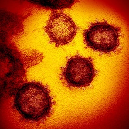 This undated electron microscope image made available by the US National Institutes of Health in February 2020 shows 2019-nCoV, the novel coronavirus that causes Covid-19. Photo: AP