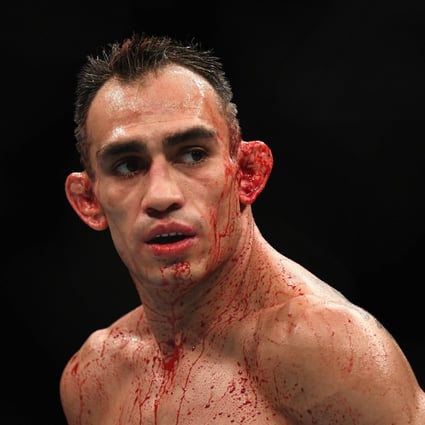 Tony Ferguson looks on while competing against Anthony Pettis at UFC 229. Photo: AFP