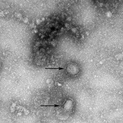 The genome sequence was released on open platforms for scientists. Photo: Handout