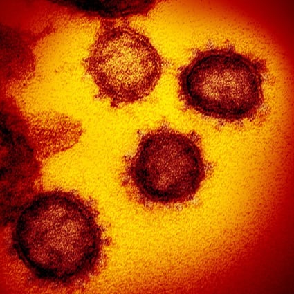 Scientists say the new coronavirus may be significantly different from Sars. Photo: AP