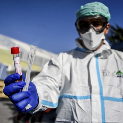 A medical worker holds out a test kit outside an emergency facility in Brescia, northern Italy on Tuesday. The nation is the worst-hit after China. Photo: AP