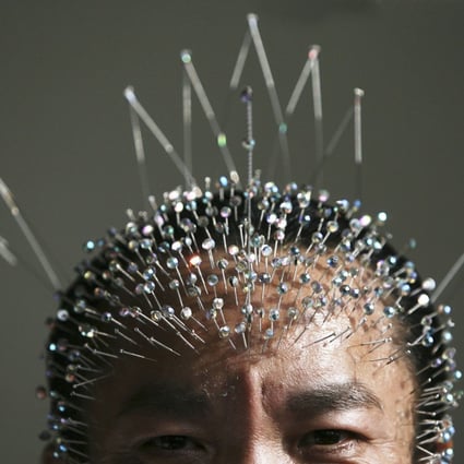 Wei Shengchu holds the record for the most acupuncture needles inserted in a human head. Chinese people have embraced Guinness World Records with gusto. Photo: China Photos/Getty Images