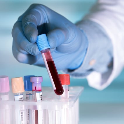 Blood group patterns of more than 2,000 patients with the coronavirus in Wuhan and Shenzhen were compared to local healthy populations. Photo: Shutterstock
