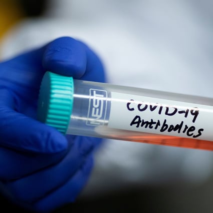A scientist holds a tube containing Covid-19 antibodies as he works on research into the disease at Tsinghua University’s Research Center for Public Health. Photo: Reuters