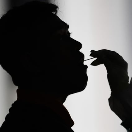 A health worker uses a swab to collect a sample for coronavirus testing. Photo: AFP