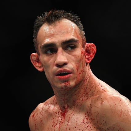 Tony Ferguson looks on while competing against Anthony Pettis at UFC 229. Photo: AFP