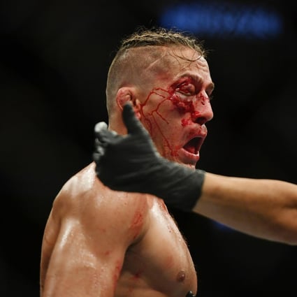 Referee Jason Herzog calls over the doctor as Niko Price struggles to see out of his eye at UFC 249. Photo: USA TODAY Sports