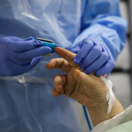 A medical worker applies a pulse oximeter to a patient in a hospital’s intensive care unit. Photo: Reuters