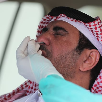 A health worker collects a swab sample from a man at a drive-through testing service for coronavirus in the Qatari capital Doha. Photo: AFP