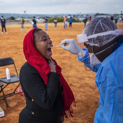 A women gets tested by a health care professional during a local government mass testing deployment in the Alexandra township, Johannesburg, South Africa, 27 April 2020. Photo: EPA-EFE