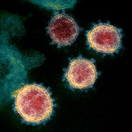 An electron microscope image shows the coronavirus that causes Covid-19. New research suggests that not everyone infected produces antibodies, or long-lasting ones. Photo: AP