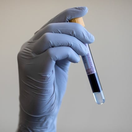 A blood sample is taken during a coronavirus antibody testing programme, as scientists race to find potential treatment options. Photo: Reuters