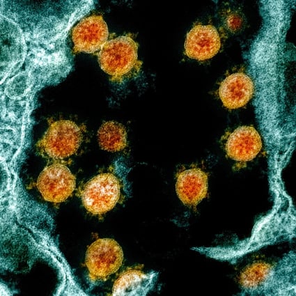 Future monitoring of viruses in animals and people could shed more light on the path the new coronavirus took. Photo: EPA-EFE