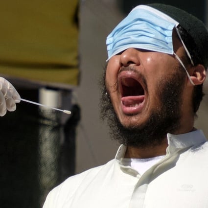 A man has a swab taken to test for Covid-19 outside a health care centre in Rome on Thursday. Photo: LaPresse via AP