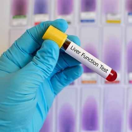 China’s liver cancer screening market could reach US$7.2 billion in 2023, according to Frost and Sullivan. Photo: Shutterstock