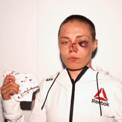 Former UFC strawweight champion Rose Namajunas poses after her fight with Jessica Andrade at UFC 251 at Fight Island, Abu Dhabi in July. Photo: Instagram / Rose Namajunas